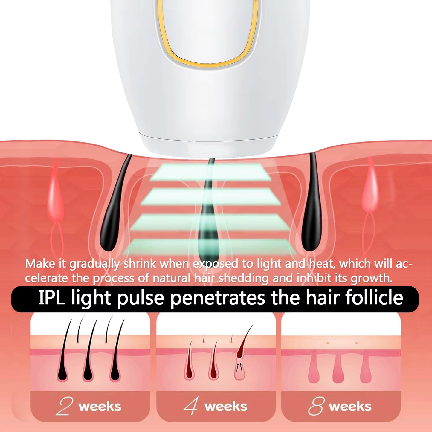 Depiladora Láser IPL